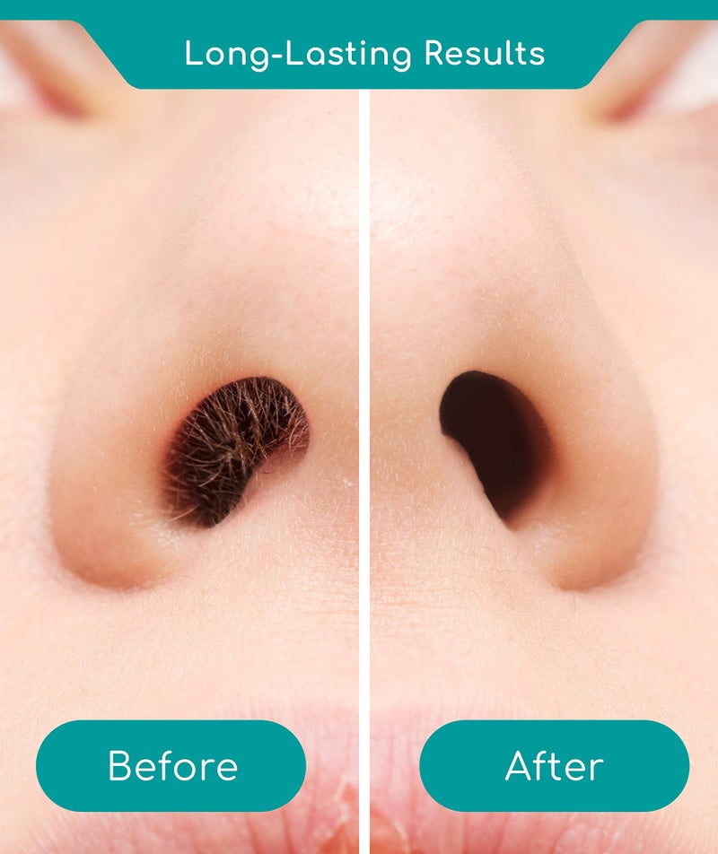 Medi Grade Nose Hair Removal Kit for Men and Women with Reusable Wax Stick, 1.76 oz - Eco-friendly Set for Removing Unsightly, Itchy Nose Hairs Includes Beads, Tape and Bag - Image 3